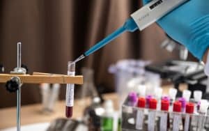 Roche Gets Emergency Use Authorization for its Coronavirus Antibody Test