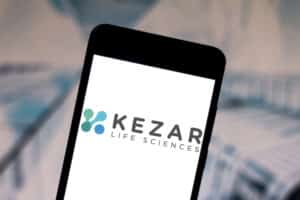 Kezar Life Sciences Jumps 77% After Topline Results of Lupus Treatment Trials
